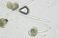 Mikroskopaufnahme von Bakterien im Institut für Mikrobiologie der Uniklinik Rostock